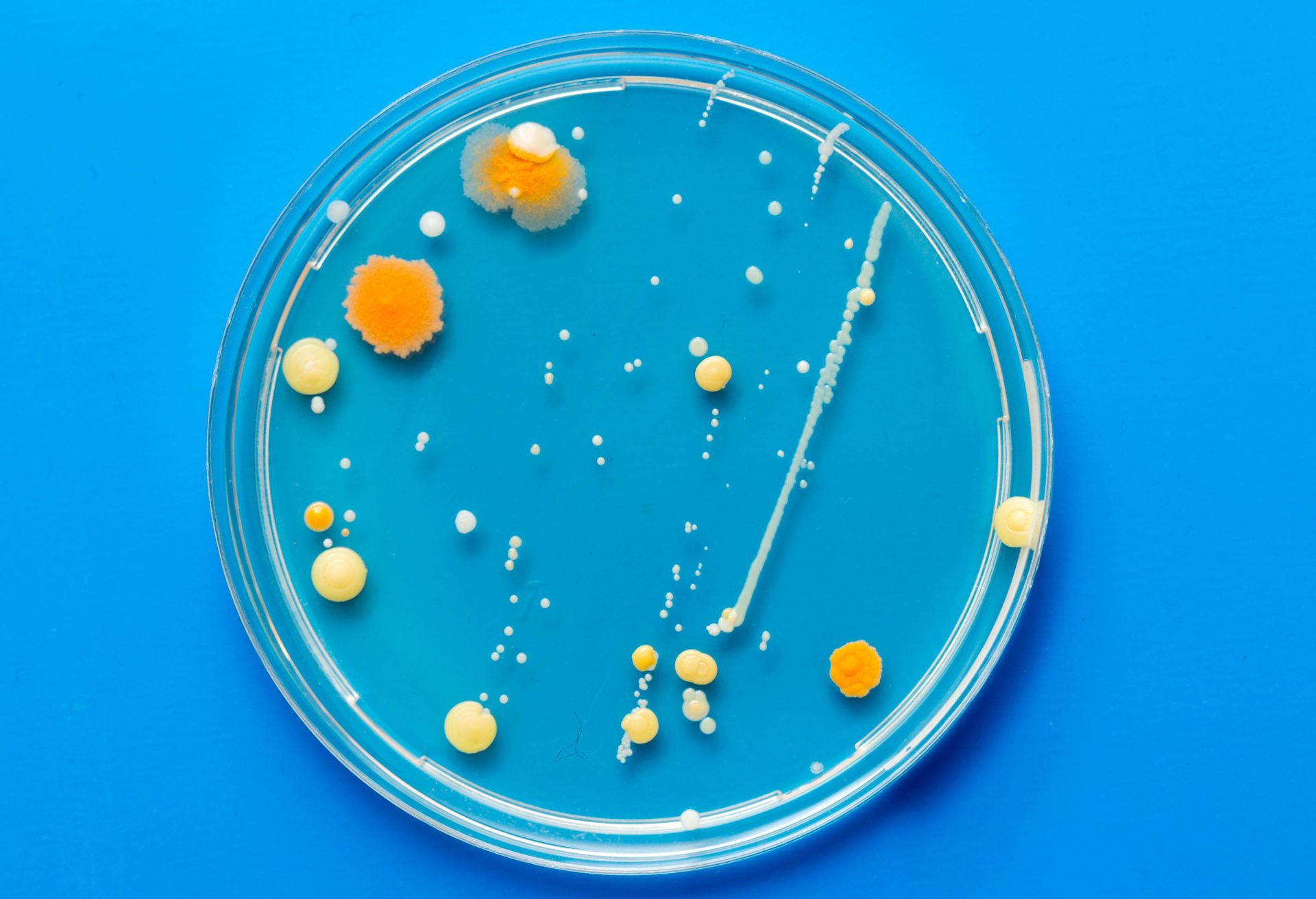 growing cultures of microorganisms, fungi and microbes_159701607